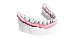 Implant dentaire Paris 15